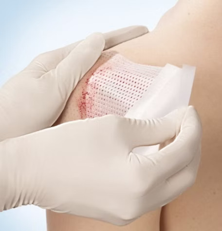 Meest voorkomende wondes